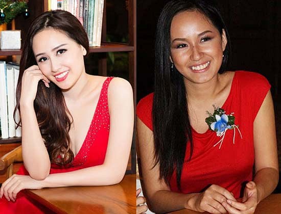 Hoa hậu Mai Phương Thúy trước khi đăng quang, cô sở hữu hàm răng được gọi đùa là “chín sáu ba không”, răng khấp khểnh không đều, nhưng kể từ khi cô niềng và làm lại răng, nụ cười của Phương Thúy rạng rỡ và xinh tươi hơn hẳn.    