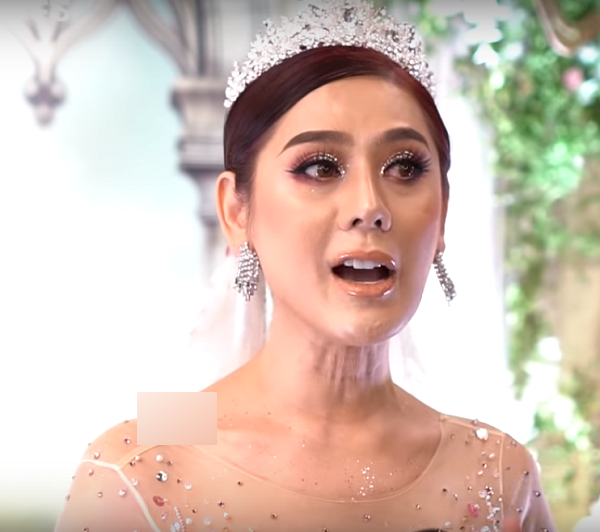 Lâm Khánh Chi lộ cùng da cổ nhăn nhúm mỗi khi nói chuyện hoặc cất tiếng hát,