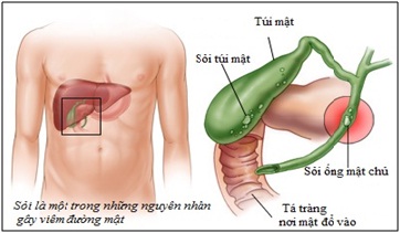 Nhan-biet-nhiem-khuan-duong-mat-1