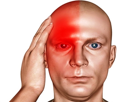 2. frontotemporal