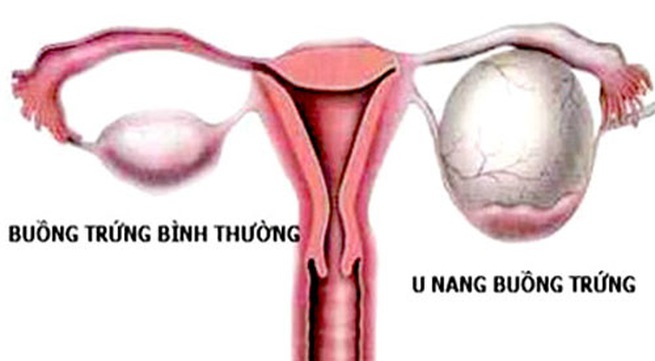 bi-u-nang-buong-trung-se-kho-co-con8dcac6b204e041f