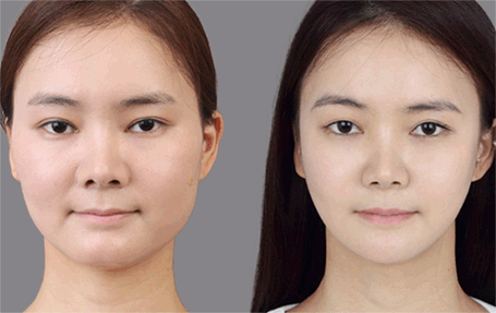 Nằm lòng 2 cách này mỡ vùng mặt chẳng mấy chốc mà thon gọn V-line