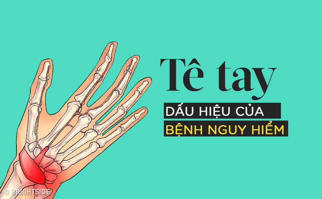 te-tay
