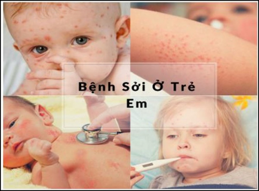 benh-soi-0