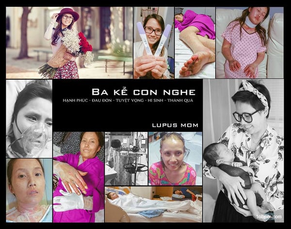 nguoi-me-mac-benh-lupus-c