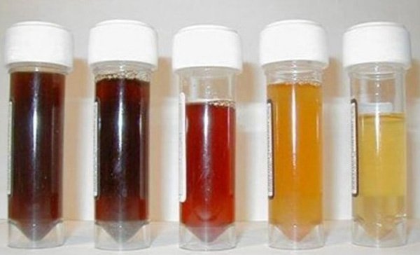 mau-sac-nuoc-tieu-4