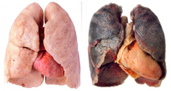 nuoc-uong-giai-doc-phoi