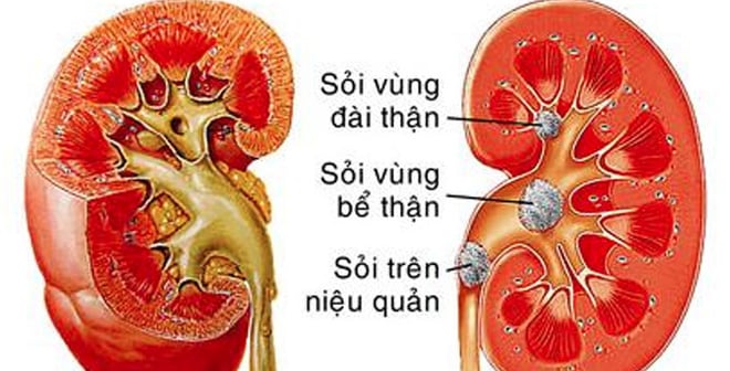 soi-than