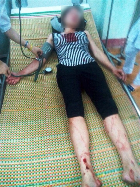 Chị Sương đang điều trị tại bệnh viện