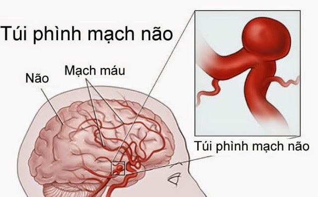 dot-quy