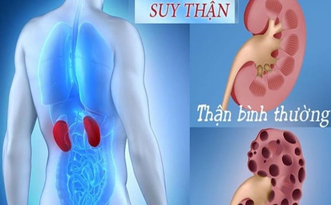 suy-than-phunutoday0