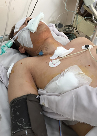 Anh P. khi cấp cứu trong bệnh viện