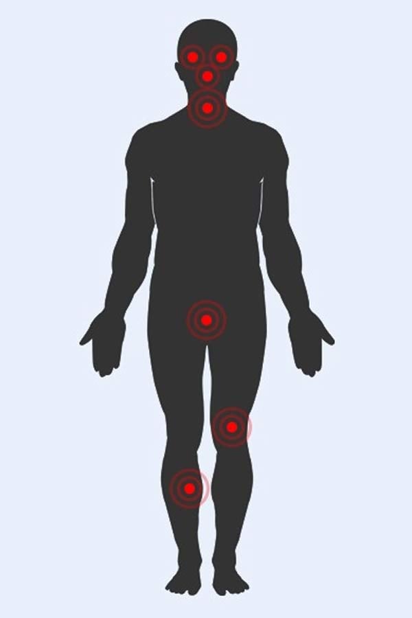 Các điểm yếu trên Sh88bet đăng ký miễn phí (chấm đỏ)