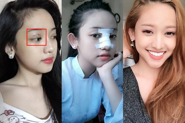 Thúy Vi thừa nhận xinh đẹp nhờ 
