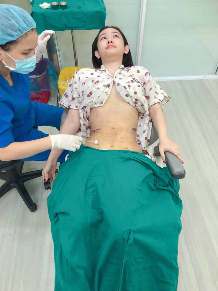 thuy-vi-1