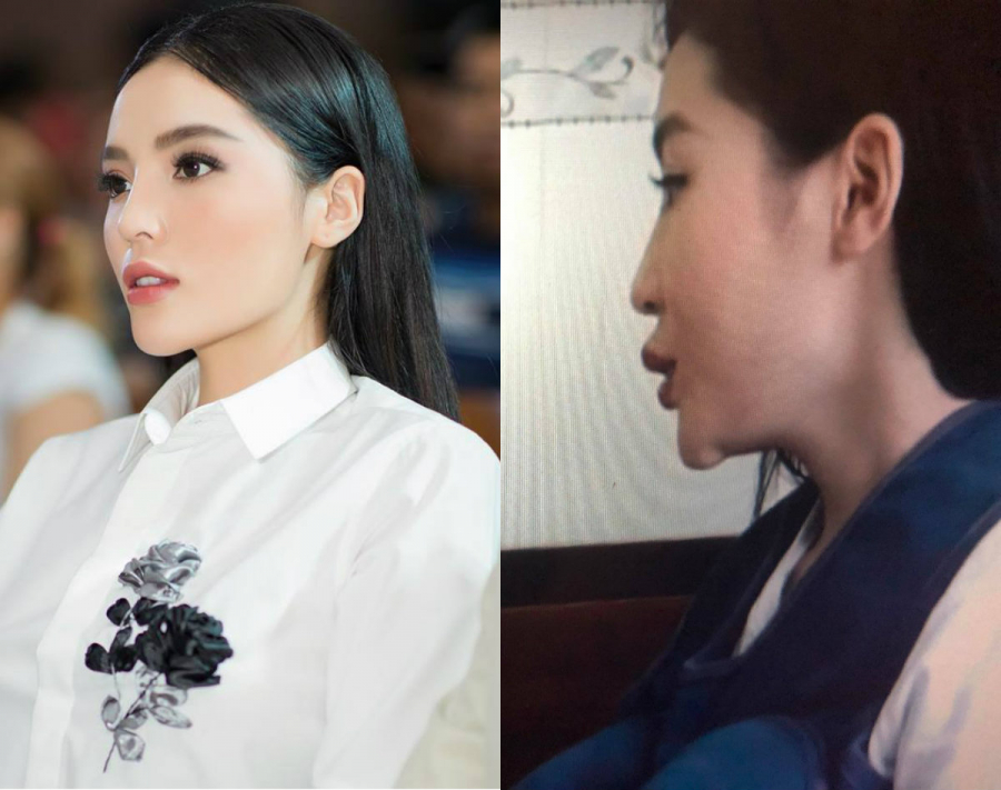 Nghi vấn Shbet888 tiền thưởng cực khủng thẩm mỹ cải thiện nhan sắc của Kỳ Duyên vẫn luôn là đề tài được khán giả dồn mọi sự chú ý suốt hai năm nay. Mặc dù Hoa hậu Việt Nam 2014 từng khẳng định mặt cô thon gọn theo thời gian là nhờ phương pháp bấm huyệt, kết hợp chế độ ăn uống giảm cân. Thế nhưng, khi xuất hiện tại show truyền hình thực tế 