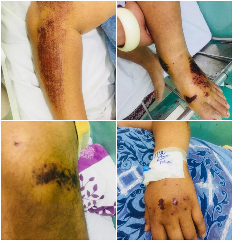 Những vết thương khắp Sh88bet đăng ký miễn phí khiến người hâm mộ không khỏi xót xa.