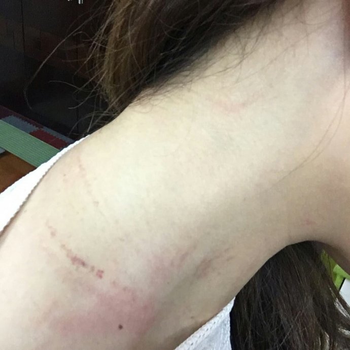 vet thuong - phunutoday
