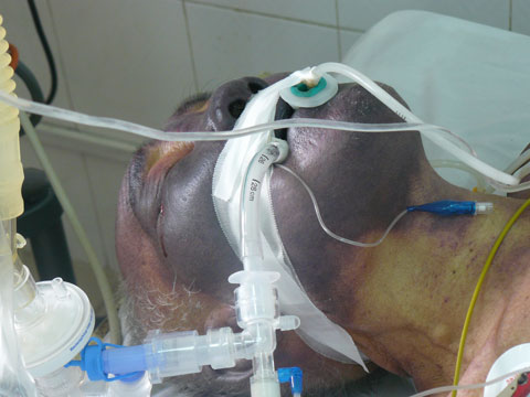 an-tiet-canh-lon-suong-mot-lan-mat-mot-doi-1