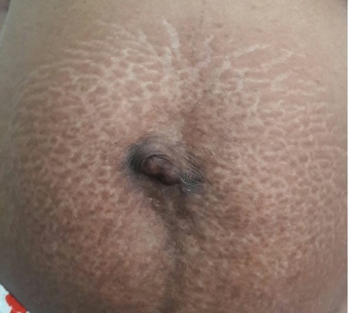 gh
