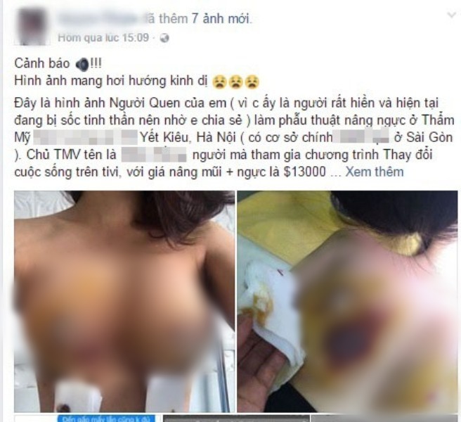phau-thuat-ngoc-1