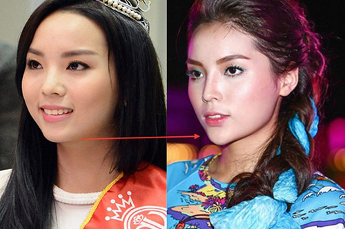 phau-thuat-phuntoday.vn 1