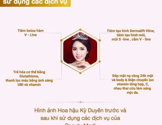 hh-ky-duyen-sharoncuneta.com 5