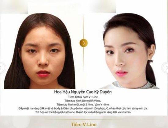 hh-ky-duyen-sharoncuneta.com 6