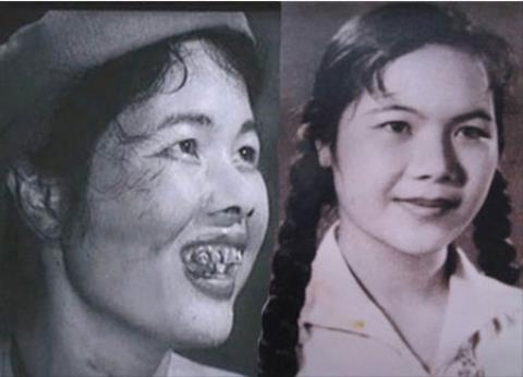 dien-vien-dong-vai-thi-no