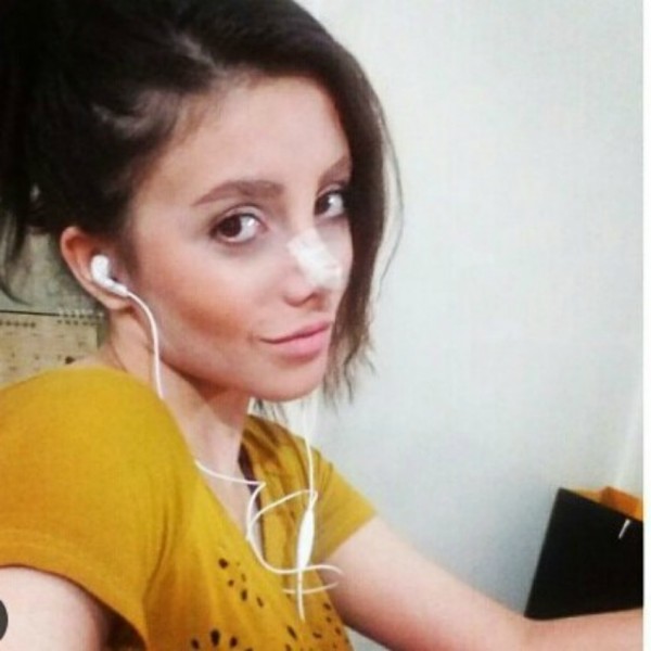 tham-my-giong-angelia jol