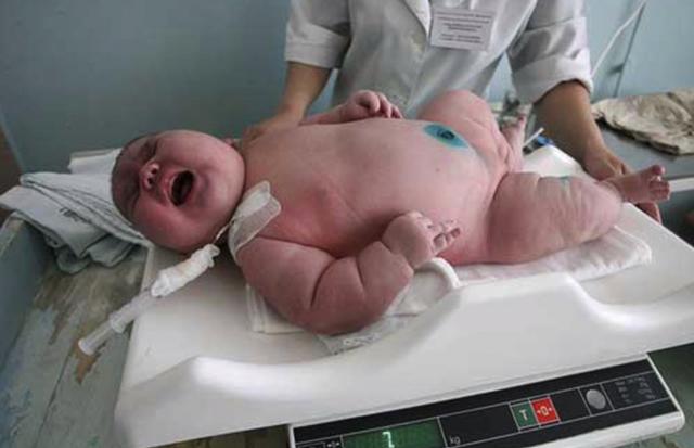 Bé Nadia với cân nặng 
