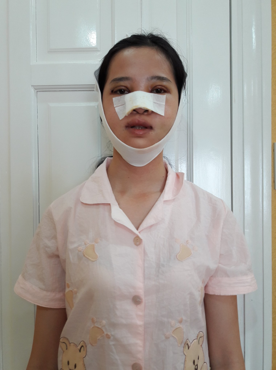 Những hình ảnh của Thảo khi phải thực hiện Shbet888 tiền thưởng cực khủng thẩm mỹ.  