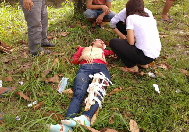 co-gai-bi-tai-nan-bat-tinh-tren-duong-truy-duoi-2-ten-cuop-giat-1