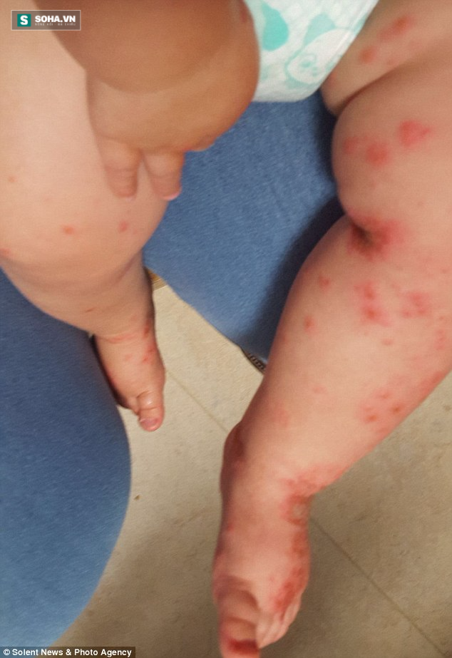 canh-bao-be-trai-1-tuoi-nhiem-loai-virus-ca-doi-khong-the-chua-khoi-chi-vi-thoi-quen-nay-cua-nguoi-lon-2