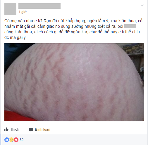 chum-anh-nhung-chiec-bung-bau-ran-nut-xau-xi-khien-ai-cung-phai-nghen-long-roi-nuoc-mat-1