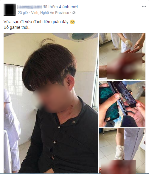 chang-trai-tre-bi-no-nat-ban-tay-vi-vua-sac-dien-thoai-vua-choi-game-1