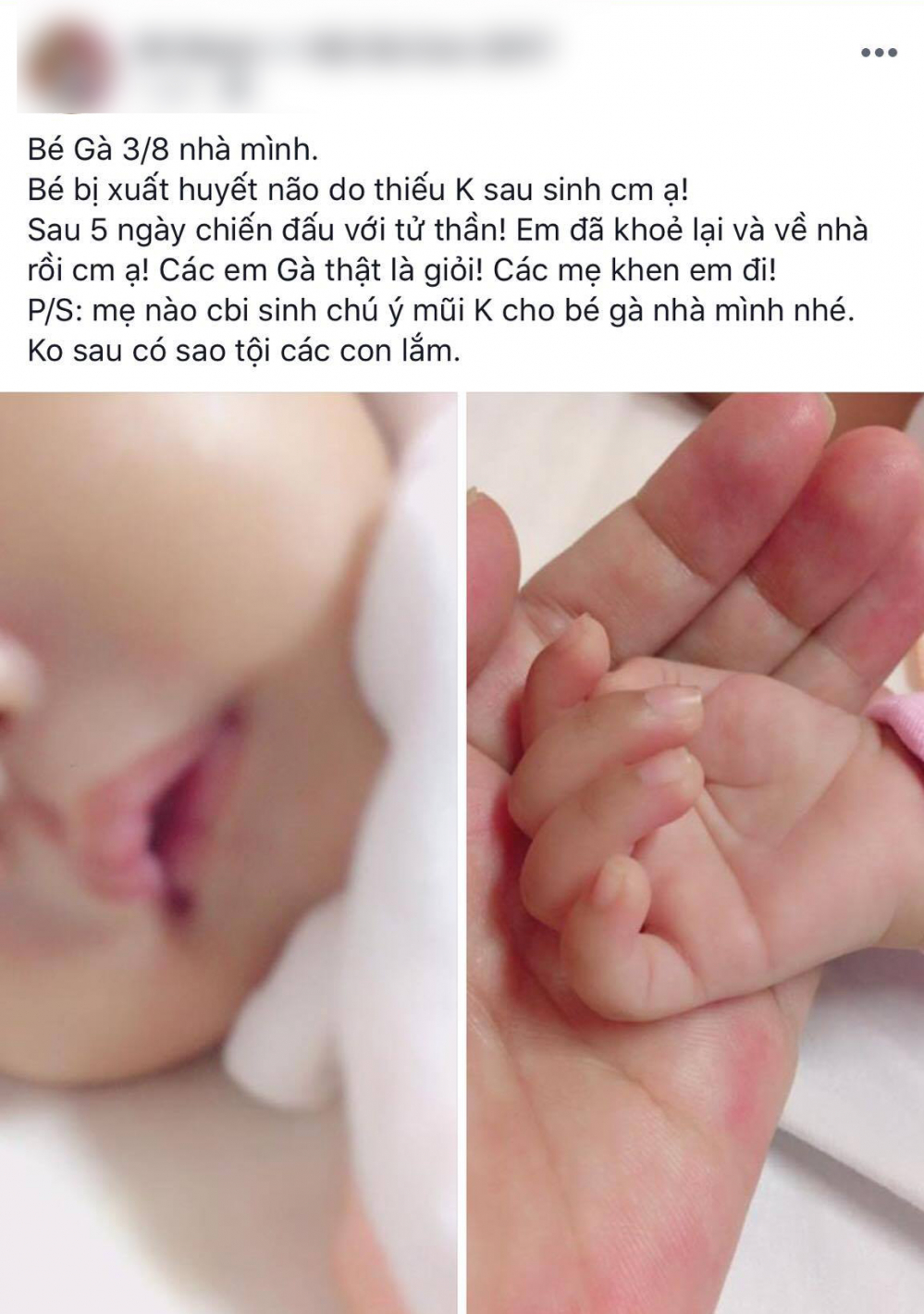 be-so-sinh-xuat-huyet-nao-do-thieu-vitamin-k-cac-phu-huynh-rat-can-luu-y-1