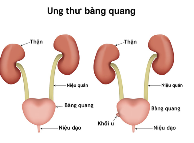 nhungdauhieunhanbietungthubangquang-1