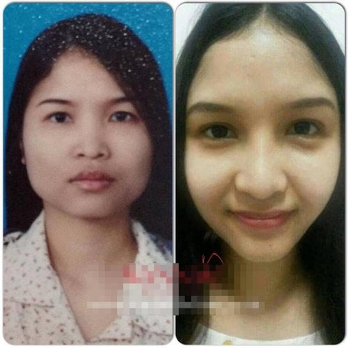 Chồng ngoại tình với vợ sau thẩm mỹ mà không biết (1)