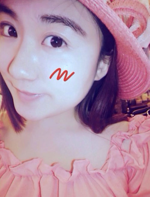 Mô tả ảnh.