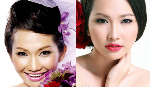 kim hiền xinh đẹp hơn sau nâng mũi