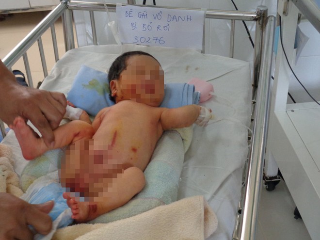 bé bị bỏ rơi ở rặng tre
