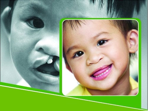 Shbet888 tiền thưởng cực khủng hở hàm ếch