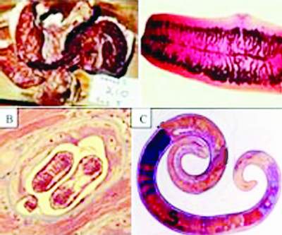 Viêm não, sức khỏe, giun xoắn, tiết canh, ẩm thực, chữa bệnh, đau răng, ăn uống, răng lợi, làm mẹ, chăm con, Shbet111 slot, casino, thể thao, xổ số, phụ nữ, Shbet16 chơi game trực tuyến