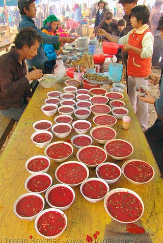 Viêm não, sức khỏe, giun xoắn, tiết canh, ẩm thực, chữa bệnh, đau răng, ăn uống, răng lợi, làm mẹ, chăm con, Shbet111 slot, casino, thể thao, xổ số, phụ nữ, Shbet16 chơi game trực tuyến
