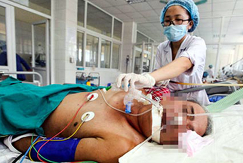 Ăn tiết canh coi chừng bị giun xoắn đóng vào não