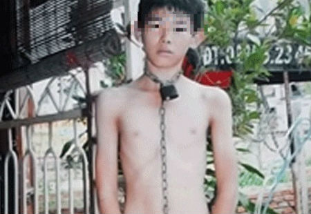 Nạn nhân bị người cha mất nhân tính bạo hành 
