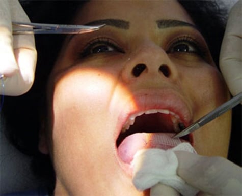  Nuốt trứng giun sán để giảm cân: Y học... chỉ có nước quỳ xuống và lạy