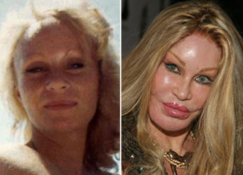 Shbet888 tiền thưởng cực khủng thẩm mỹ
