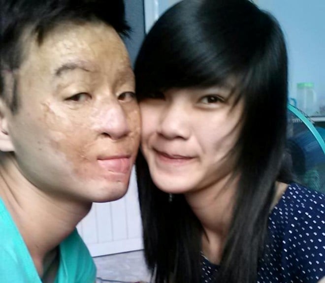 Mô tả ảnh.